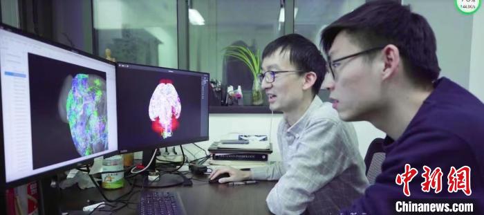 给大脑绘制“高清图谱” 中国科学家新研究有助启发新一代人工智能