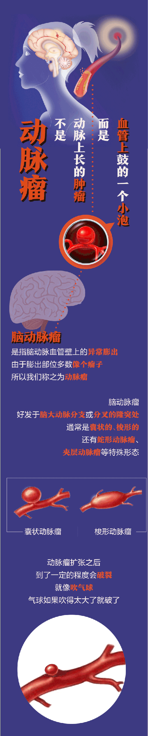 突然头痛？警惕！4种情况要马上去医院