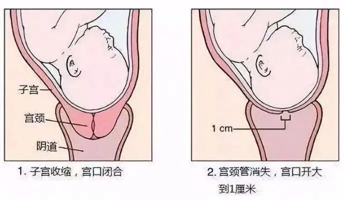 宫颈管长度图片