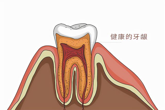 牙龈出血是什么原因导致的？