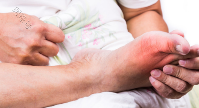 痛风患者可以用热水泡脚吗？答案或与你想的不同