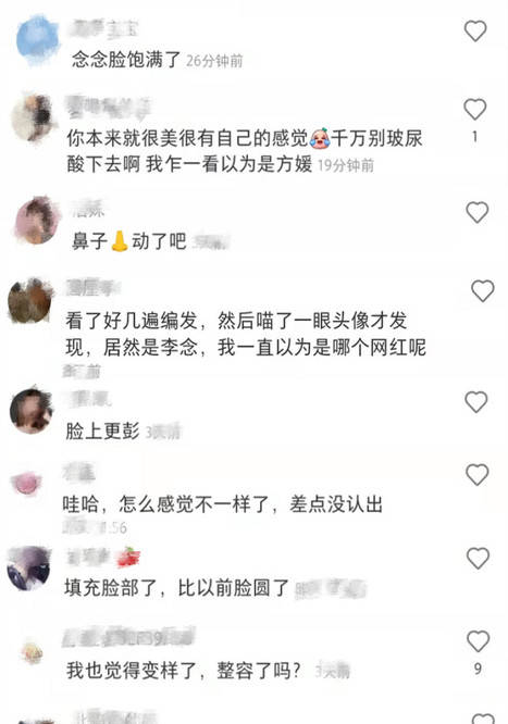 “阔太”李念被指整容，脸僵失真越来越像网红，网友齐呼认不出