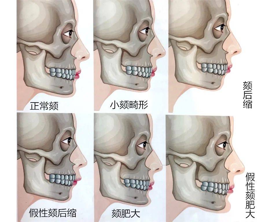 据说她是她的整容模板？这偷脸程度真比血缘还真吧？！