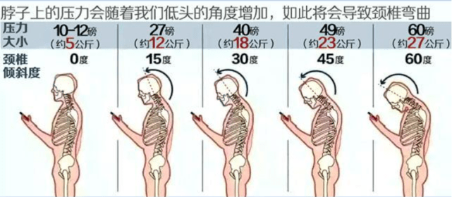 为什么我们偏爱不良姿势？