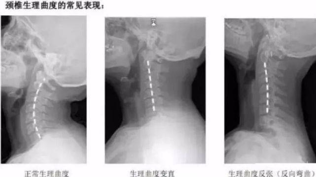 为什么我们偏爱不良姿势？