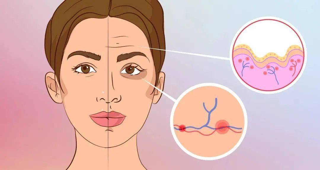 NEJM：晒太阳加速皮肤衰老——不可逆？这项医美别错过