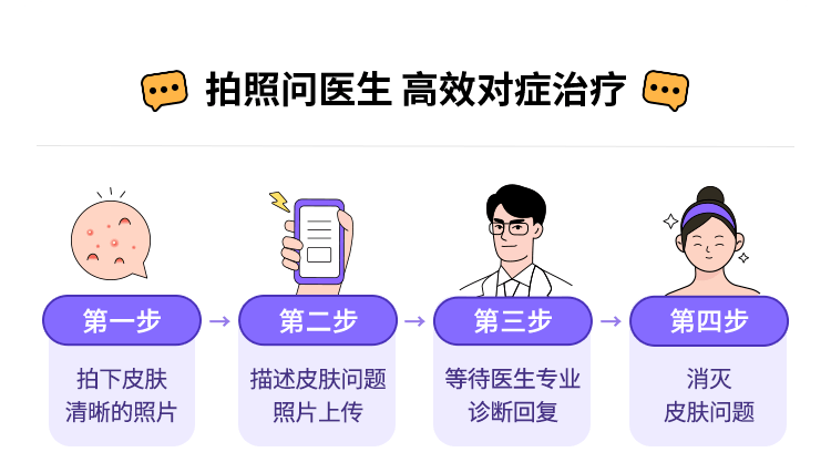 湿疹能自愈吗？