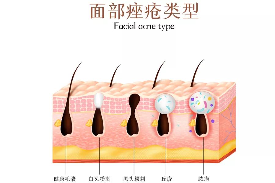 皮脂腺具体位置图片