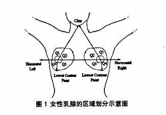 将 乳腺划分为外上,内上,内下和外下四个象限,并据 此将整个乳房分为5