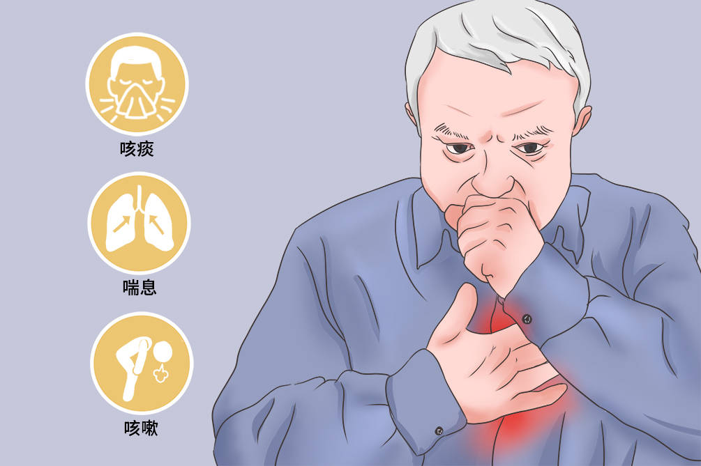 慢阻肺如何确诊确诊慢阻肺的五个症状三大体征你知道吗