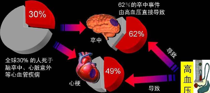 心血管科主任 戒掉这5个坏习惯