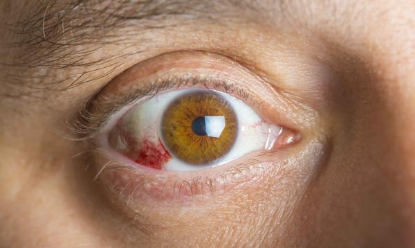 眼部有这五个症状出现,或是糖尿病眼病到来的信号,早发现早就医