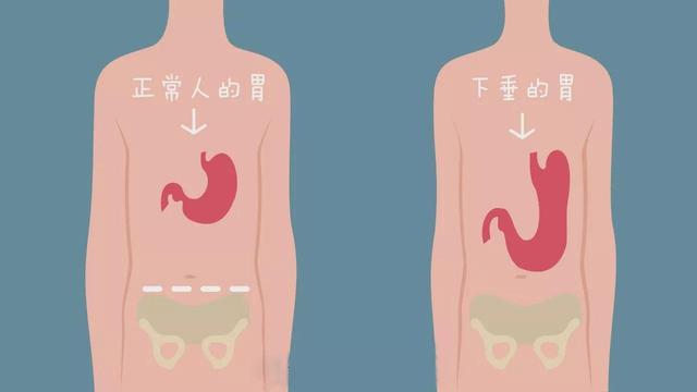 胃胀气的位置在哪图片图片