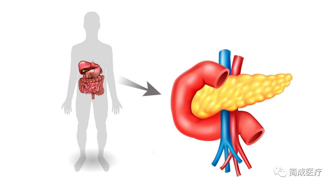 重症急性胰腺炎经鼻肠管肠内营养的护理