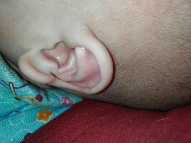 婴儿耳垂有折痕图片