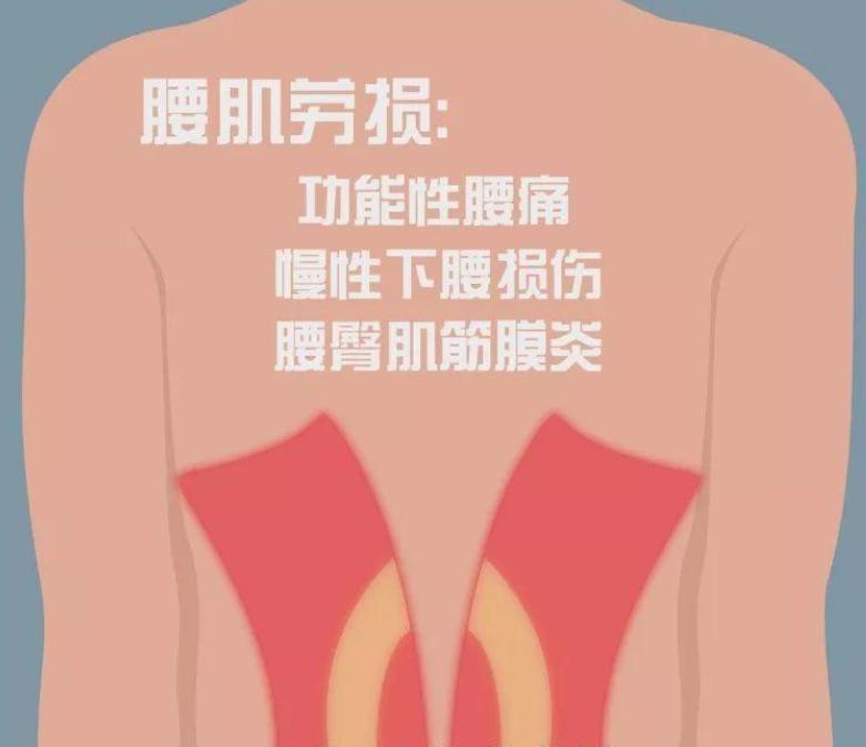 知名作家治疗腰肌劳损入了坑怎么治才是王道