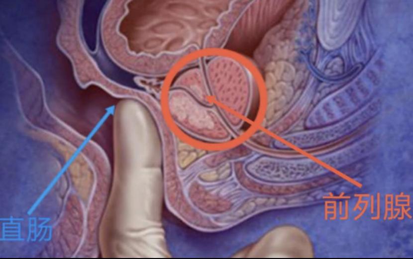 前列腺移行带和外周带图片