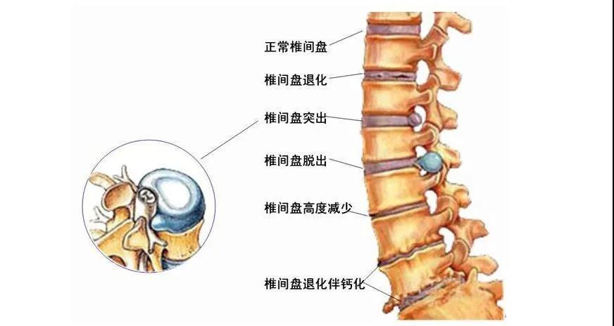 腰椎骨性标志图片