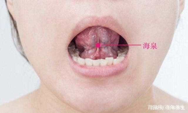 重舌肿胀,热极难言,刺激海泉穴