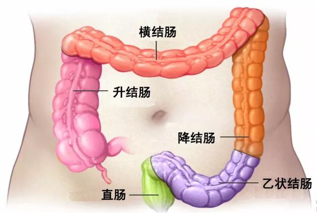 就医后ct检查显示:文先生的结肠肝曲局部增厚,肠腔狭窄,伴结肠梗阻,有
