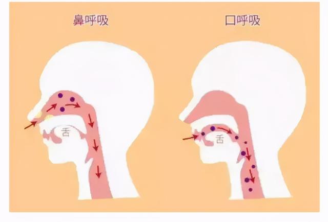 腺樣體肥大分為生理性和病理性,由於腺樣體位於人體免疫的第一防線,且