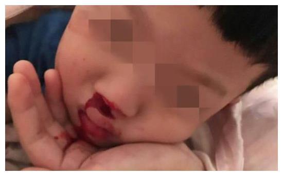 2岁儿子流鼻血昏过去,医生检查后宣告已死亡,只怪妈妈这个动作