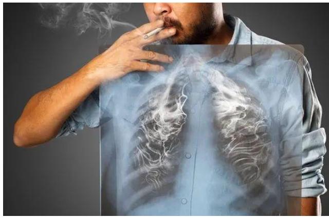 多少岁戒烟,肺还可以恢复到正常?医生:尽量不要超过这个年龄