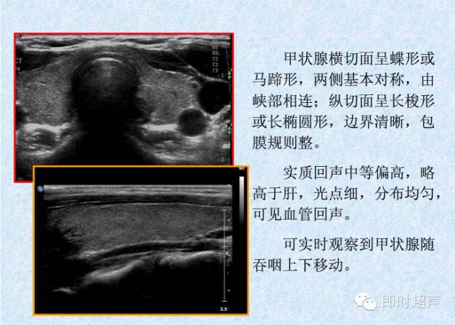 史上最实用甲状腺超声诊断