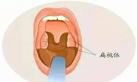 男性扁桃体图片