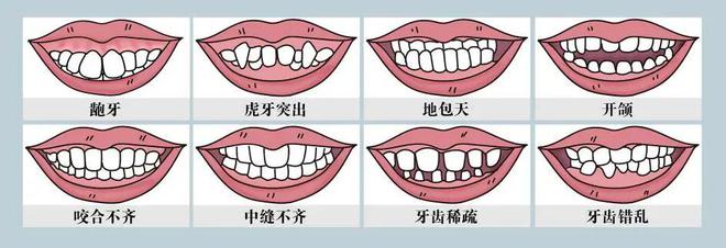 不限户籍年龄,暑期牙列不齐筛查今起报名!