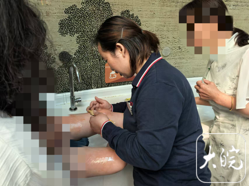 女童意外烫伤，安徽一高速服务区紧急救助